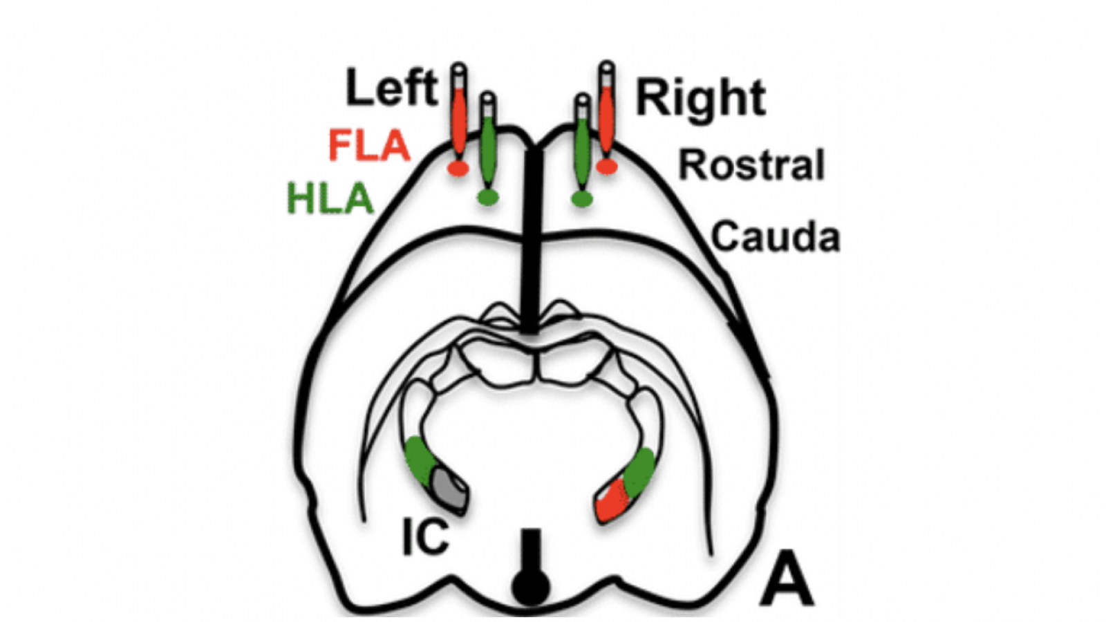 left and right imaging